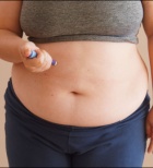 קידום לסתות - תמונת אווירה